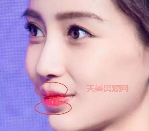 香肠嘴真的需要改变吗？  也许，你只需要改变一下审美标准！