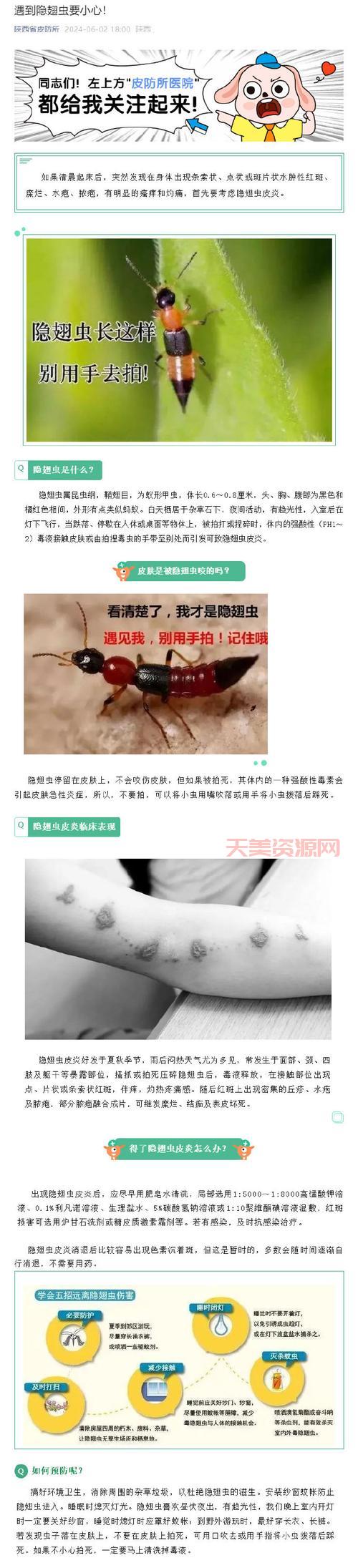 被隐翅虫咬了怎么办？隐翅虫百科教你紧急处理！