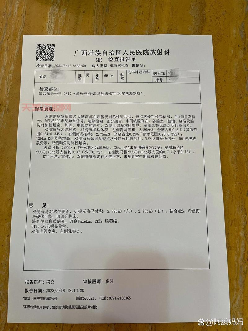 磁共振能检查出什么？这些常见疾病都能查出来！